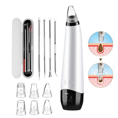 Kit Aspirateur à Point Noir
