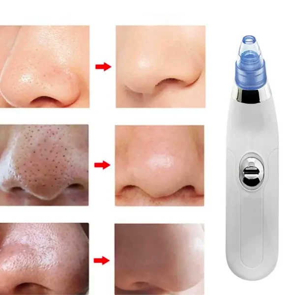 Aspirateur de Nez Point Noir