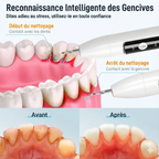 Détartreur Dentaire Ultrason