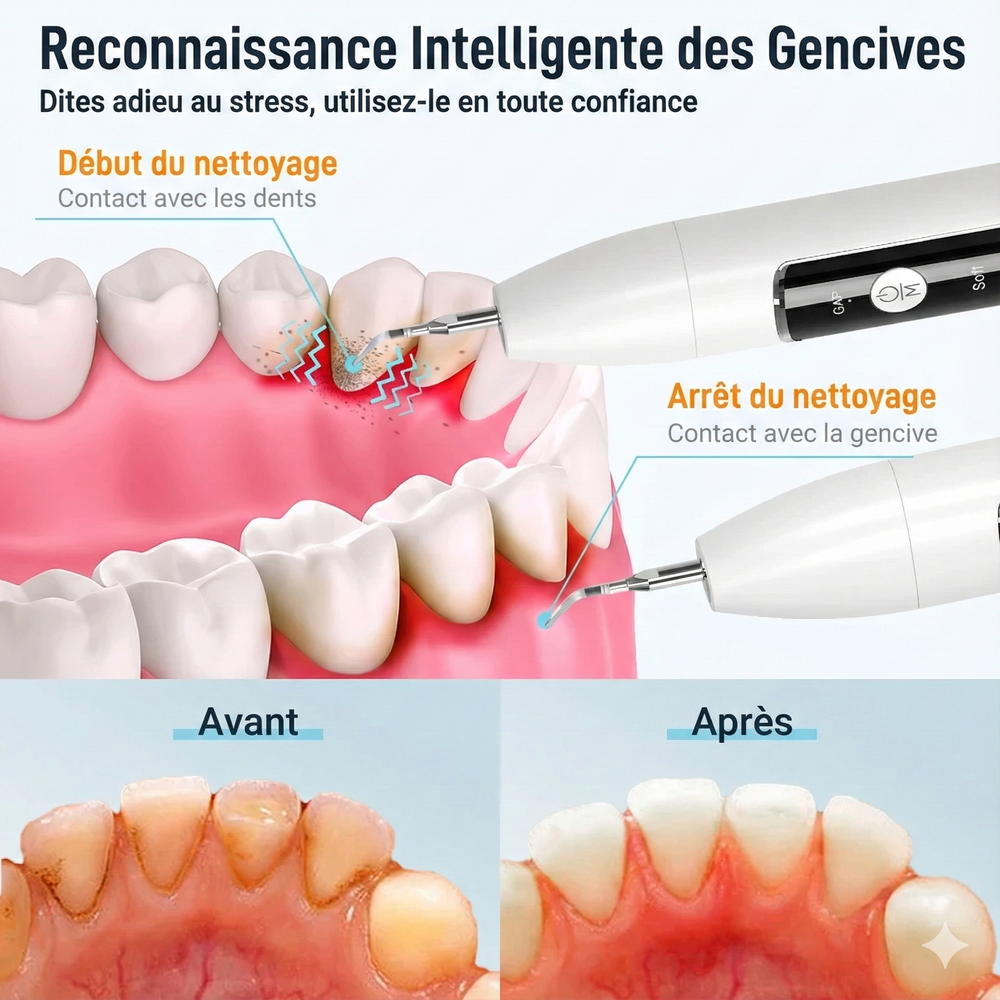 Détartreur Dentaire Ultrason