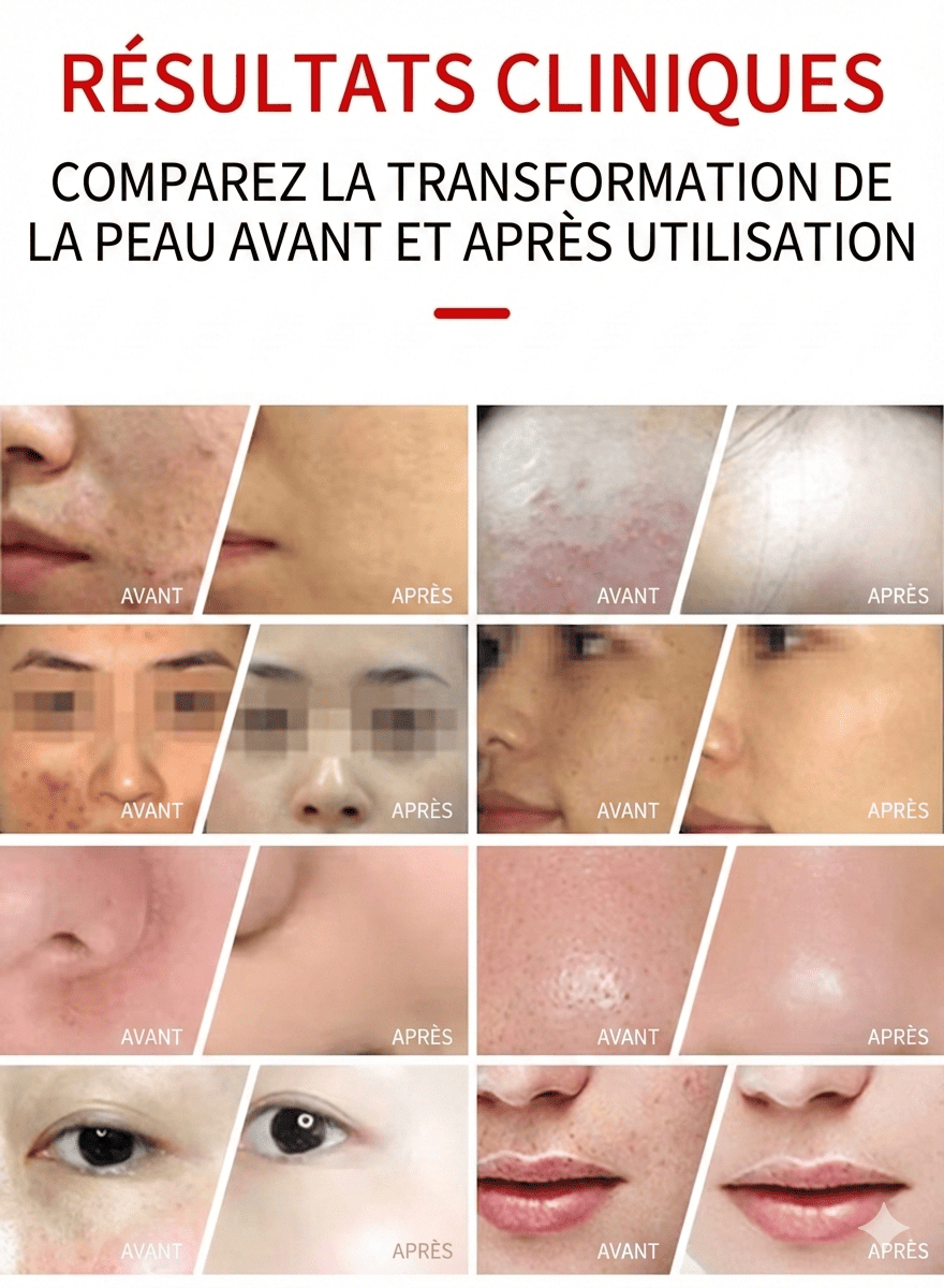 Tunnel de Luminothérapie LED 7 Couleurs & Brume Froide