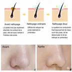 Brosse Nettoyante Visage  Silicone Vibrante