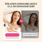Épilateur à la Lumière Pulsée 990000 Flashs