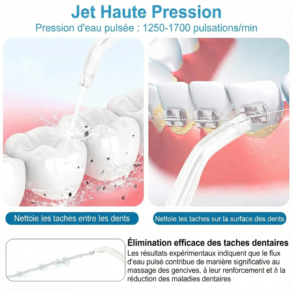 Jet Haute Pression Dentaire