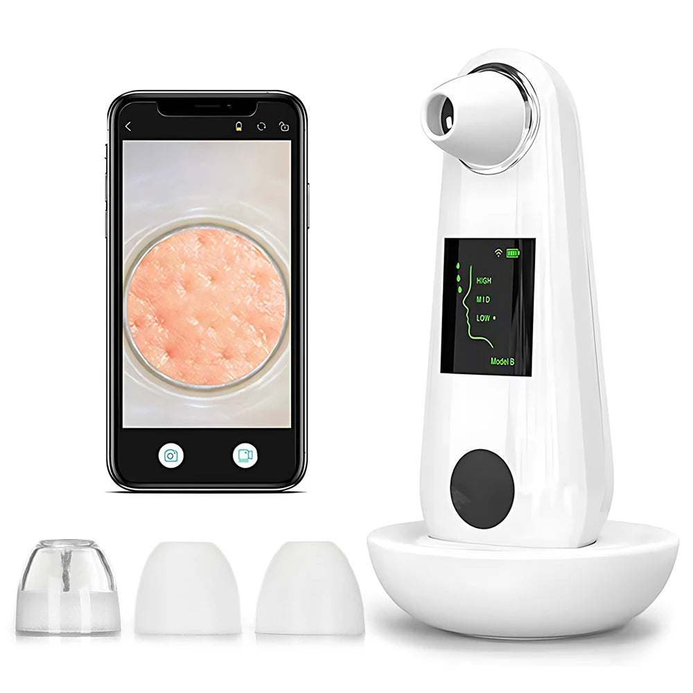 Machine pour Aspirer les Points Noirs