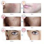 Masque Facial Led 7 Couleurs