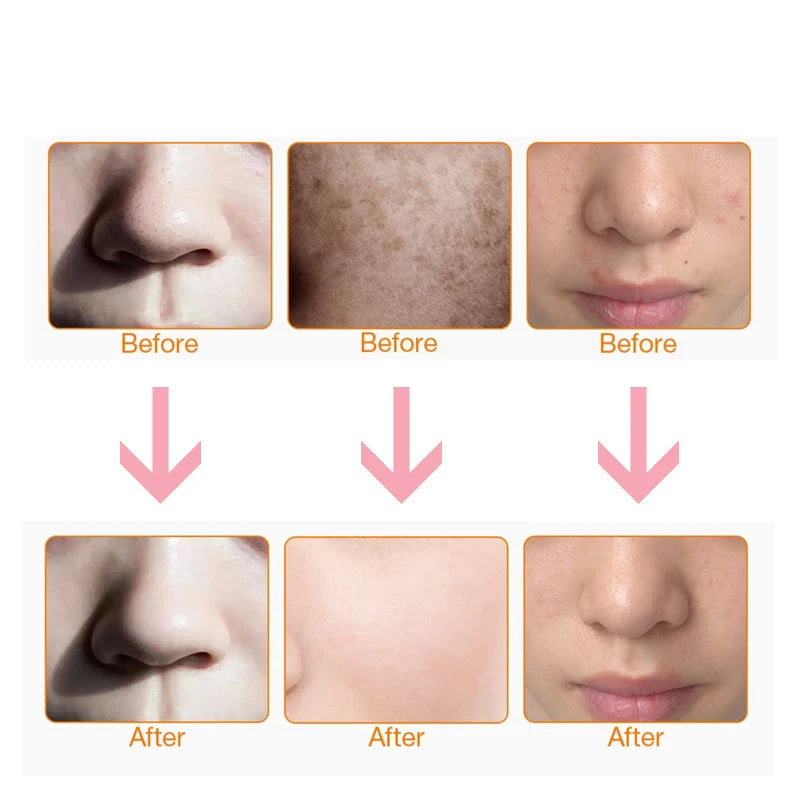 Masque Led Visage 7 couleurs