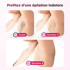 Épilateur Lumière Pulsée Compact