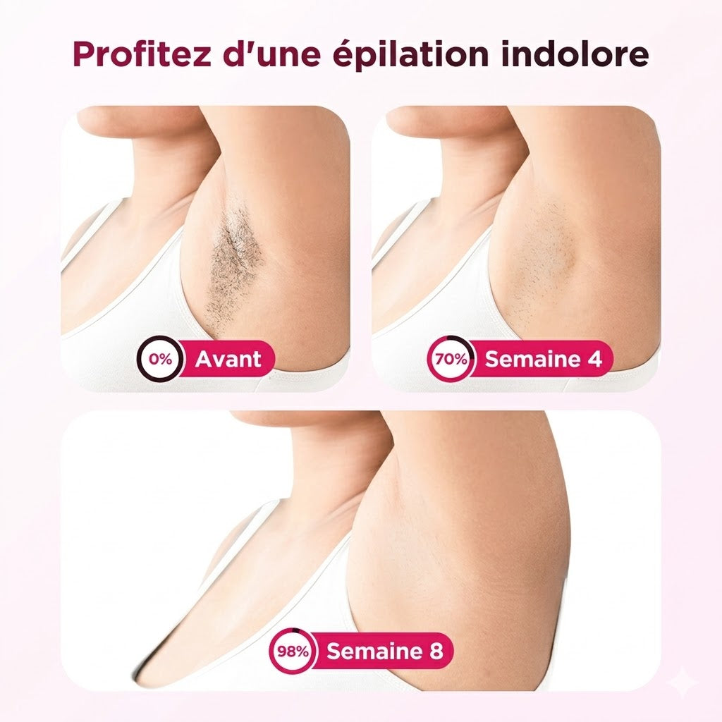 Épilateur Lumière Pulsée Compact