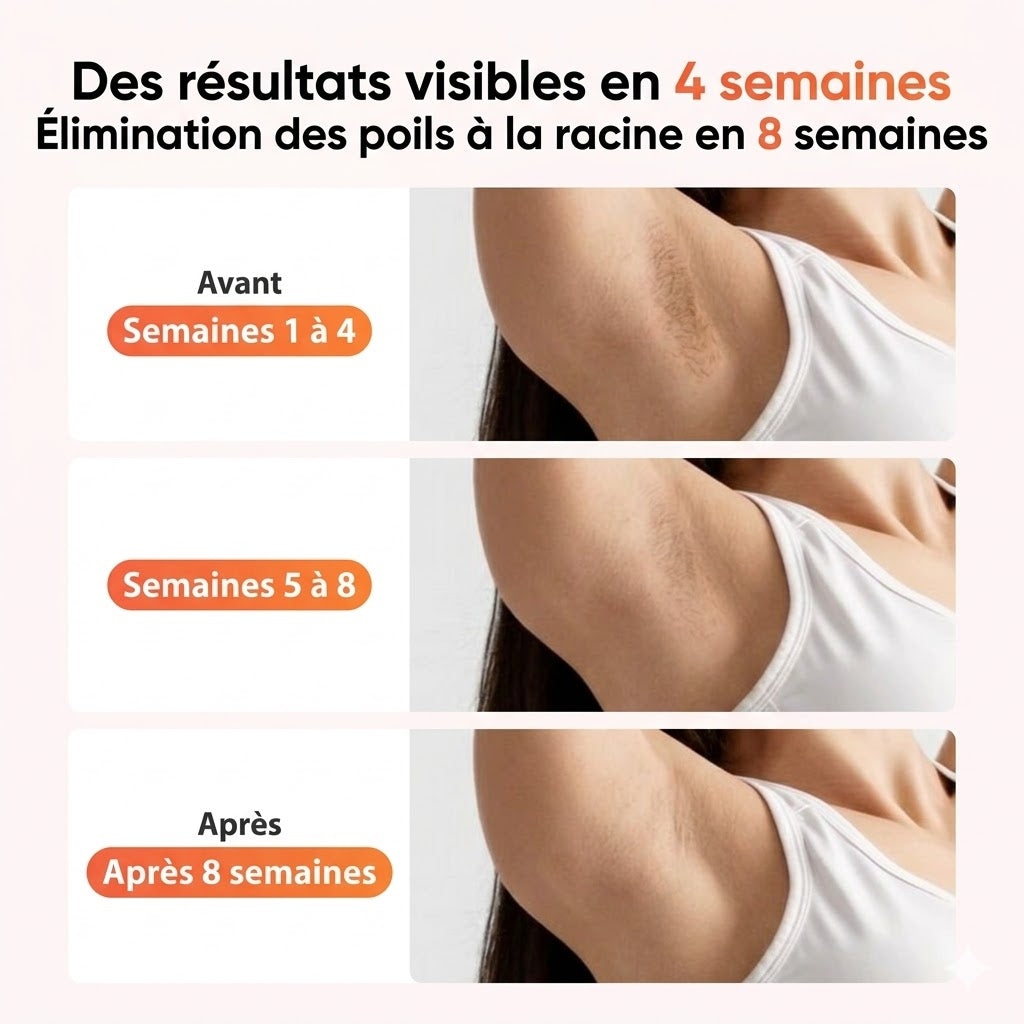Épilateur à Lumière Pulsée