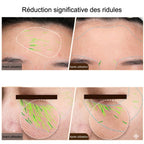 Appareil Lifting Visage EMS Radiofréquence