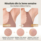 Épilateur Lumière Pulsée avec Effet Froid